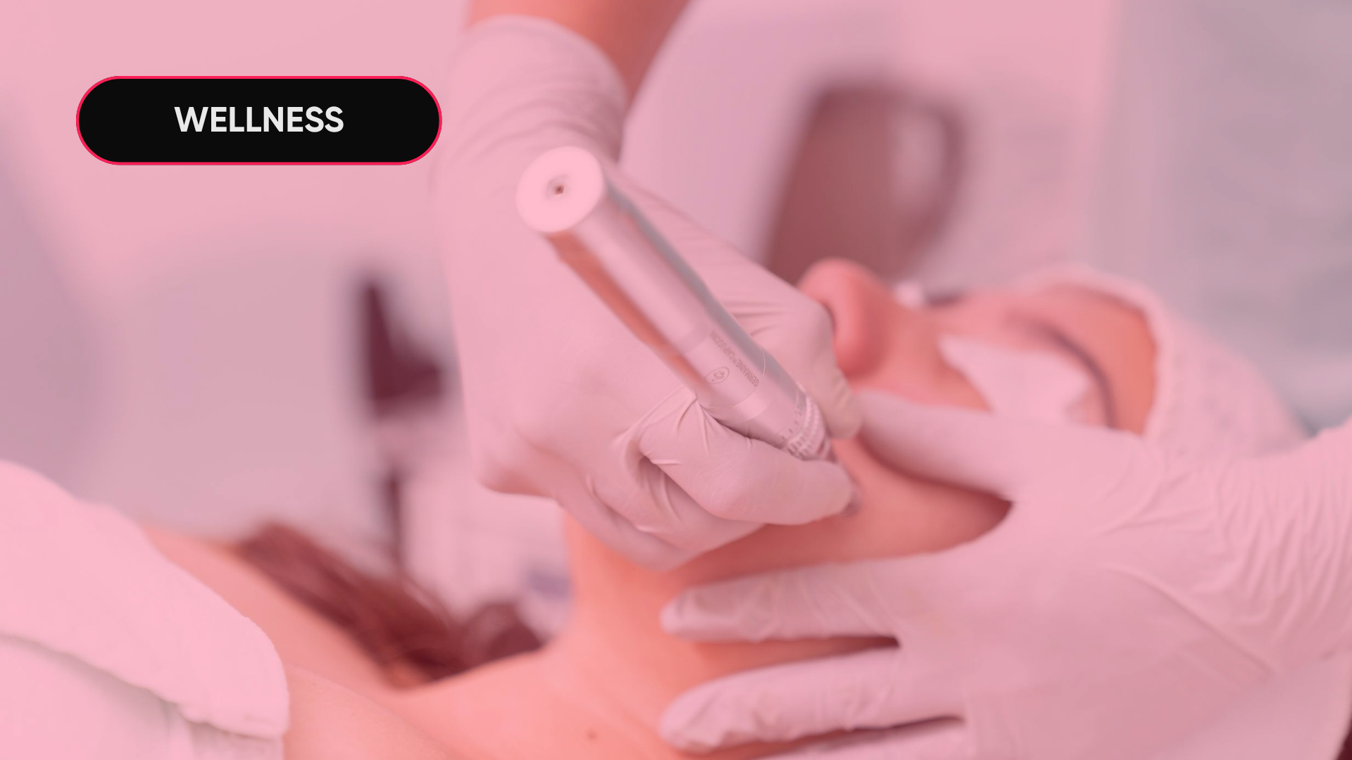 casos-visibilidad-ia-clinica-estetica-madrid